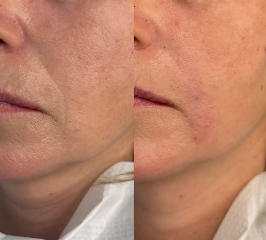 Makijaż permanentny oczu